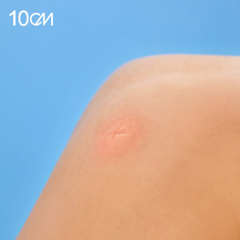 10CM-《방에 모기가 있어 (4.4)》